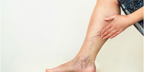 Varislerden Kurtulma Yöntemleri